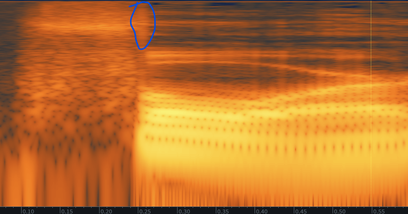 Spectrolgram of a Human Voice with Mouth Clicks Leftover With One Loud Click After Mouth De-Clicking
