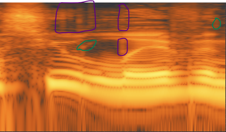 of a Human Voice with Mouth Clicks